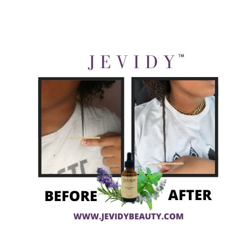 Jevidy Scalp Revitalization Drops for hair growth, moisture and length retention